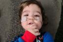 Two-year-old Elijah Kay-Haigh, of Horsforth, who needs a specialist car seat